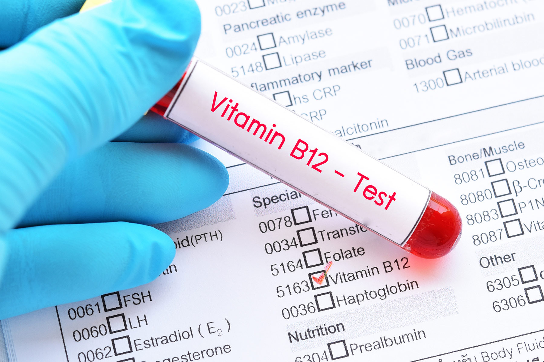 Vitamin B12 — facts and fallacies