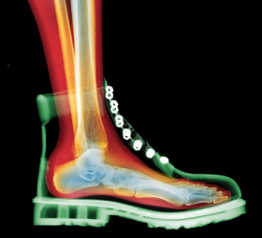 What happens to your body if your shoes don’t fit?