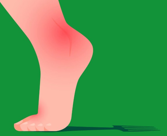 What is gout, and why is it on the rise?